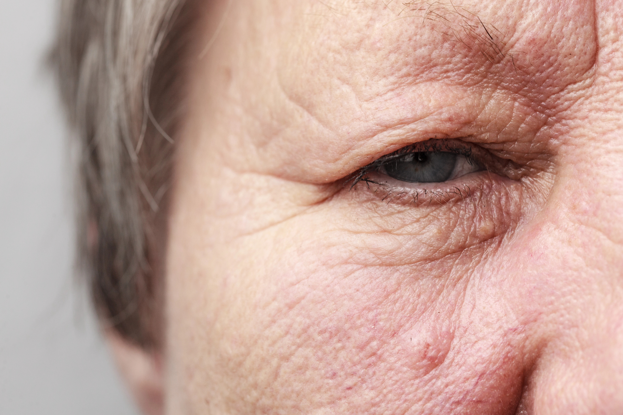 Gube na obrazu so del mene in nosim jih s ponosom.